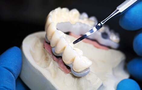 自分で取り外しできる