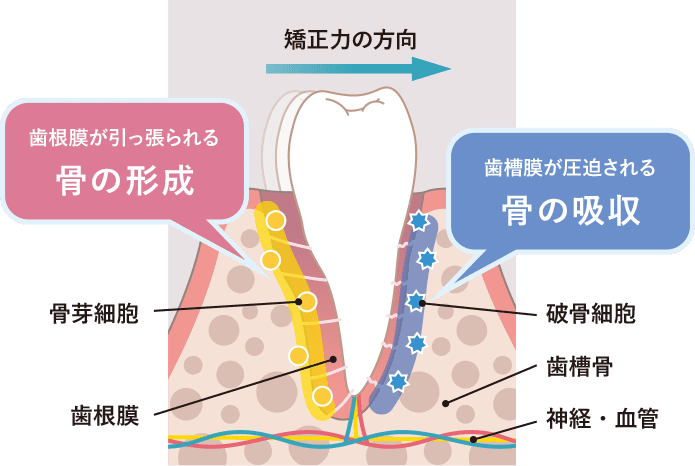 強制力がかかった歯周組織