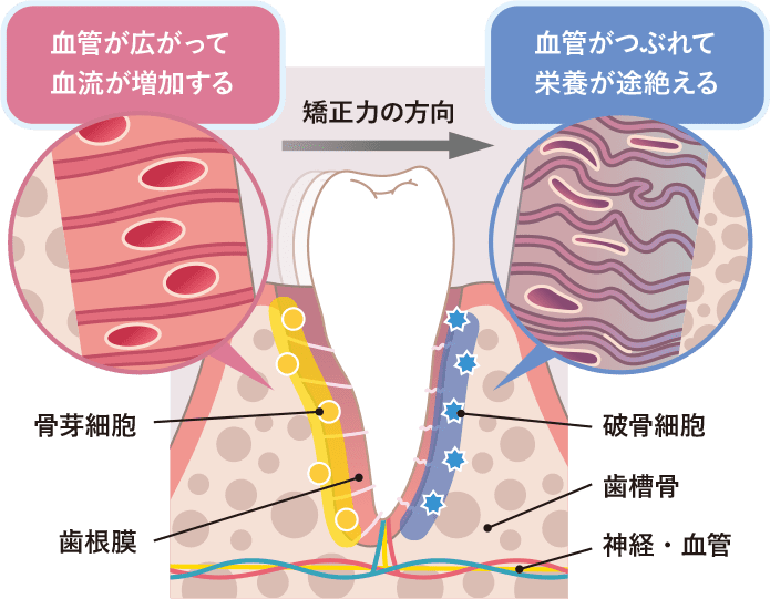 強制力がかかった歯周組織