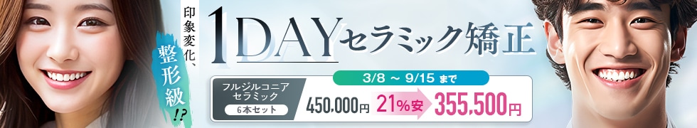 1dayセラミック