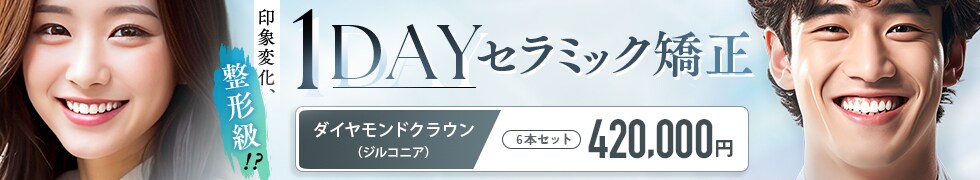 1dayセラミック