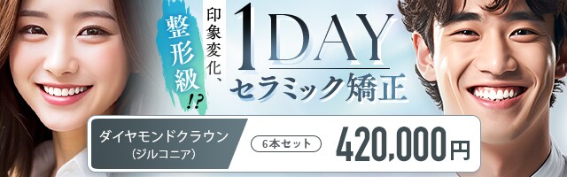 1dayセラミック