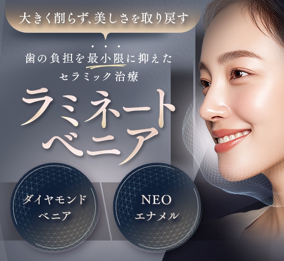 ラミネートベニア