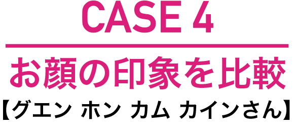 歯並びで顔の印象はここまで変わる 湘南美容歯科