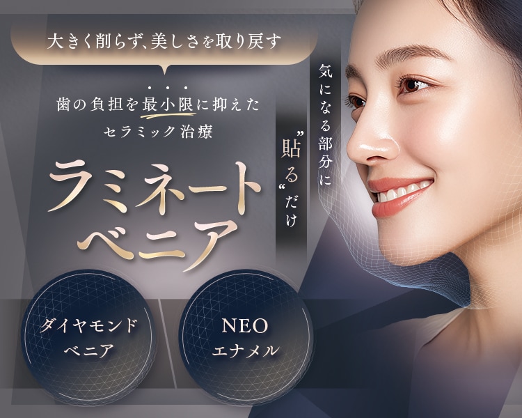 ラミネートべニア