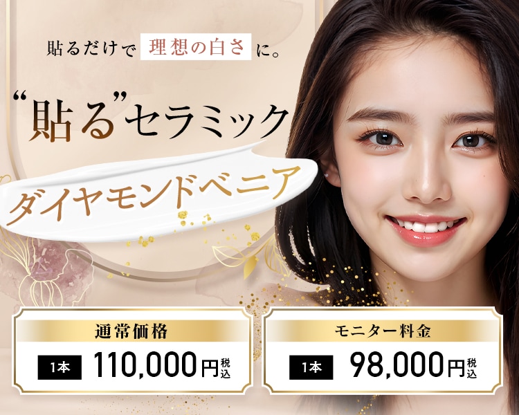 セラミックを使ったダイヤモンドベニア