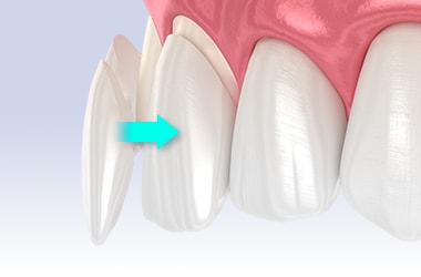 ダイヤモンドベニアのイメージ