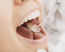 精密検査の実施