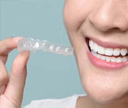 マウスピースの制作と治療開始