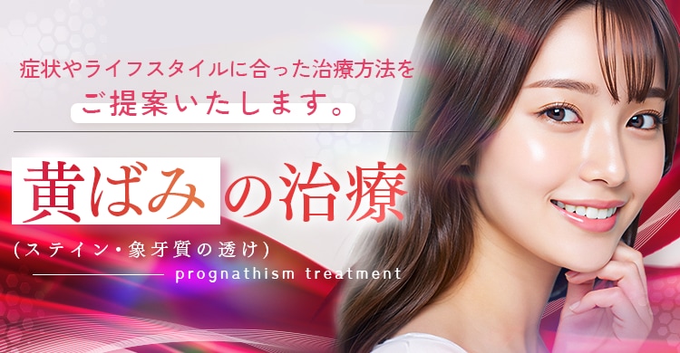 歯の黄ばみ治療