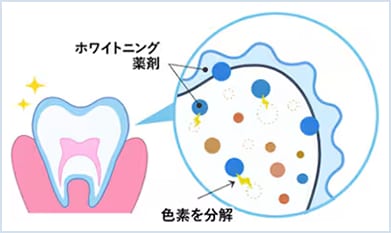 ホワイトニング薬剤イメージ