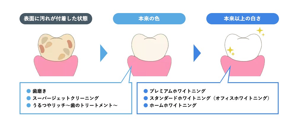 着実に白くしたい方は？