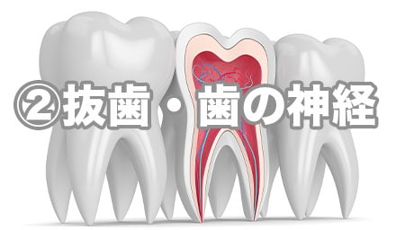 ②場合によっては抜歯・歯の神経を抜くから