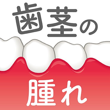 保険の被せ物が入っているところの歯茎の腫れ？炎症してるときの対処方法を紹介！