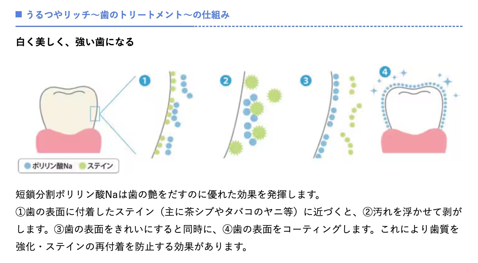 「うるつやリッチ」のコーティングで着色防止！