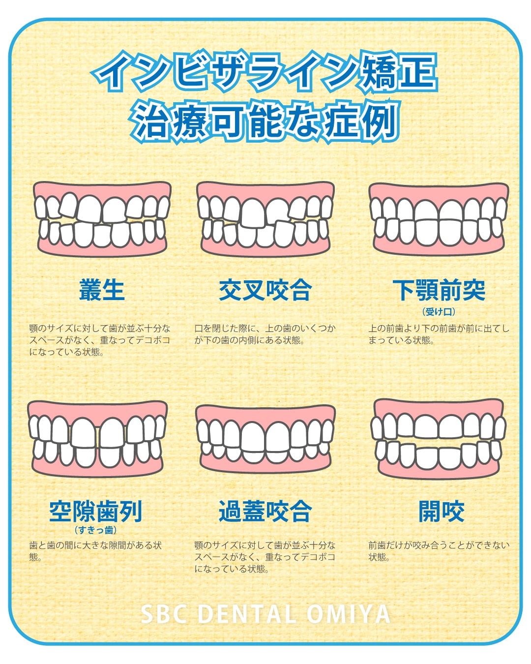 ガタガタしている前歯の歯並び矯正から奥歯から全体的な歯列の矯正まで可能