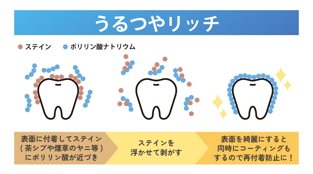 負担がかかった歯にはトリートメントでうるおいを♡