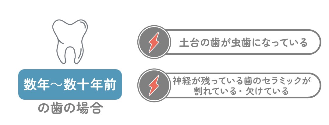 数年～数十年前に治療した歯の場合