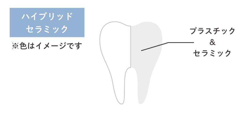 ハイブリッドセラミック