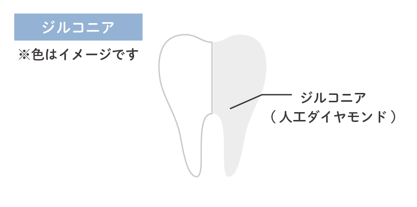 ジルコニア